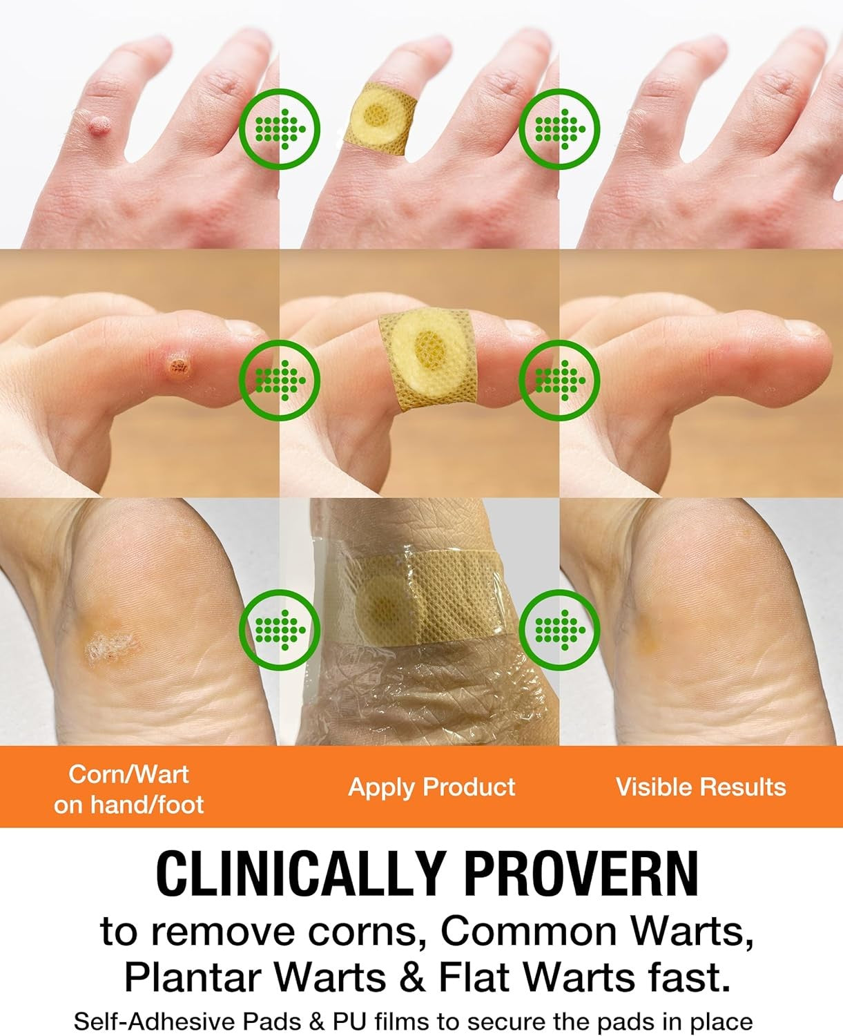 Wart Corn Remover Pads for Feet: 42 Pack 40% Salicylic Acid Extra Strength
