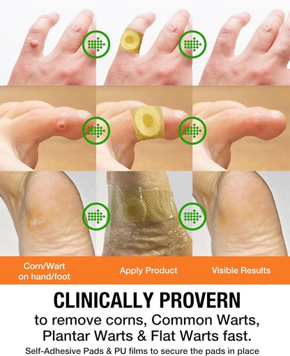 Wart Corn Remover Pads for Feet: 42 Pack 40% Salicylic Acid Extra Strength