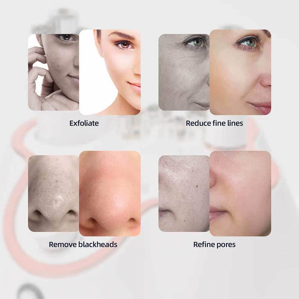 Diamond Facial Peeling Machine Home Use Professional Microdermabrasion Nano Water Spray Exfoliation Beauty Machine