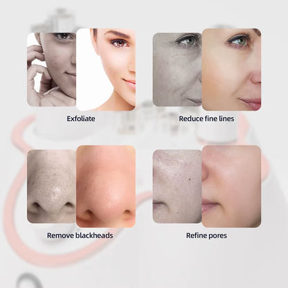 Diamond Facial Peeling Machine Home Use Professional Microdermabrasion Nano Water Spray Exfoliation Beauty Machine
